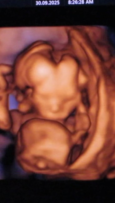 Saved public reels media preview 5 from @paulodybala snapshot