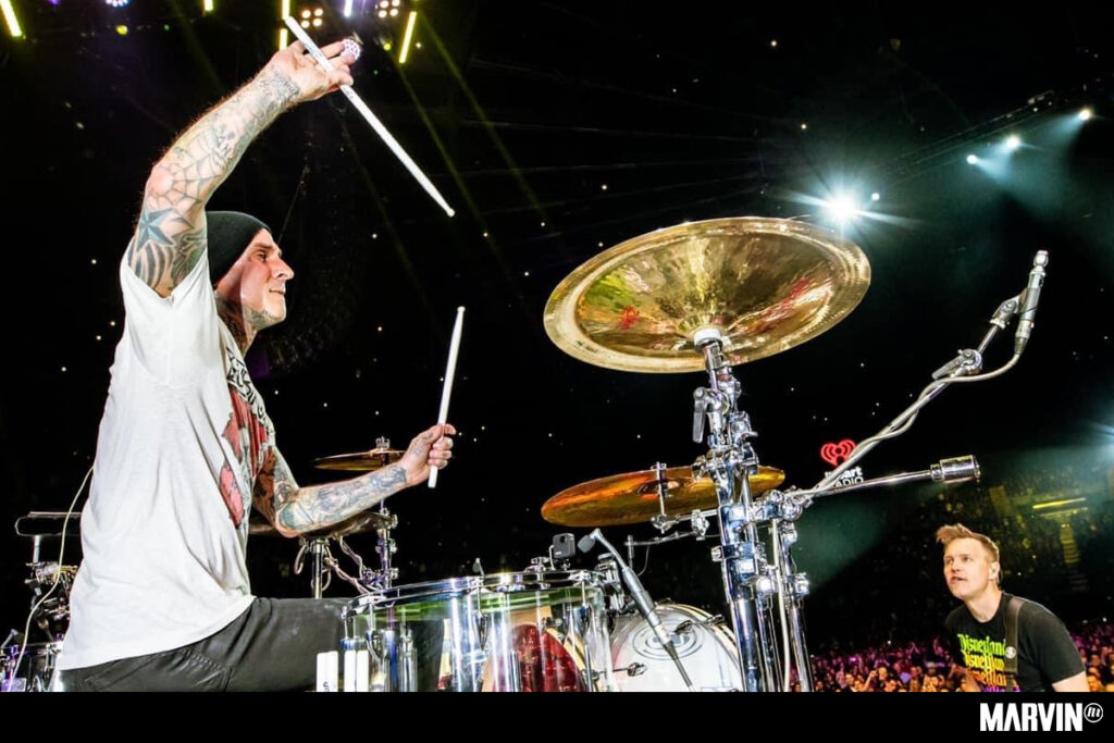 Travis Barker comparte actualización sobre su operación