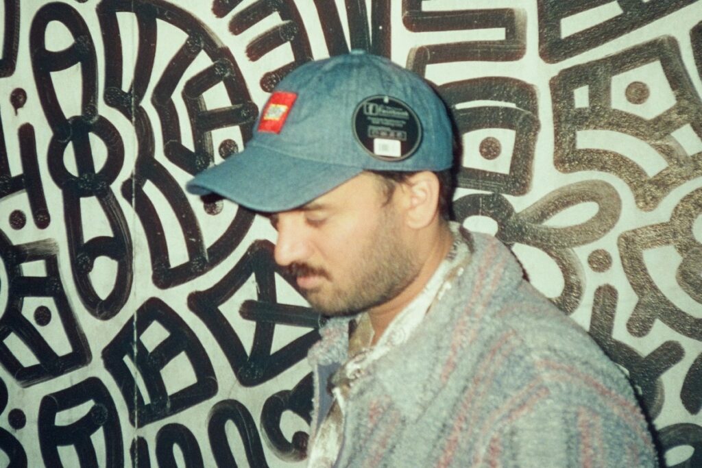 Café Marvin tras y ante el calor epidural con Snad