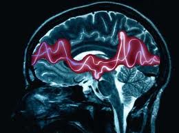 Las epilepsias son afecciones neurológicas crónicas.