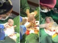 Trillizos gemelos solo se puede dar con una doble división de un solo óvulo fecundado, en este caso sin ninguna fertilización asistida.