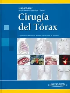 Carátula de Cirugía del tórax