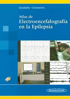 Carátula de Atlas de electroencefalografía en la epilepsia