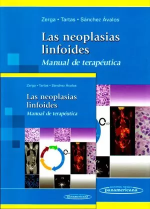 Carátula de Las neoplasias linfoides