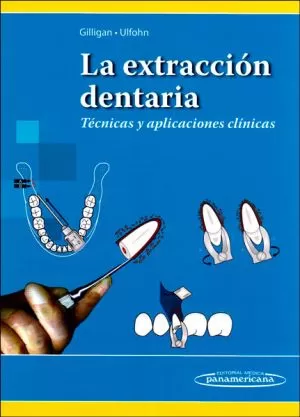 Carátula de La extracción dentaria