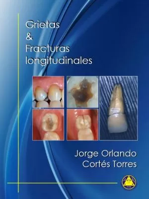 Carátula de Grietas y Fracturas Longitudinales
