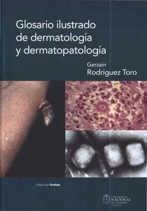 Carátula de Glosario Ilustrado de Denmatología y Dermatología