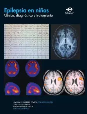Carátula de Epilepsia en niños