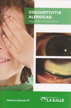 Carátula de Conjuntivitis alérgicas