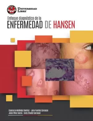 Carátula de Enfoque diagnóstico de la enfermedad de Hansen