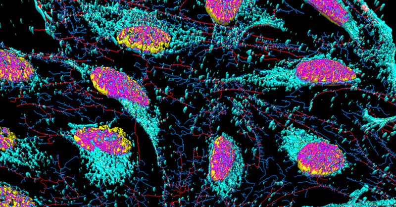 Henrietta Lacks' Cells Contributed to Breakthrough Medical Advancements. Now, Her Family Will Finally be Compensated. - Vimarsana News
