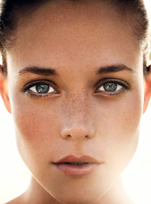 End of Summer Dermal Filler Special!