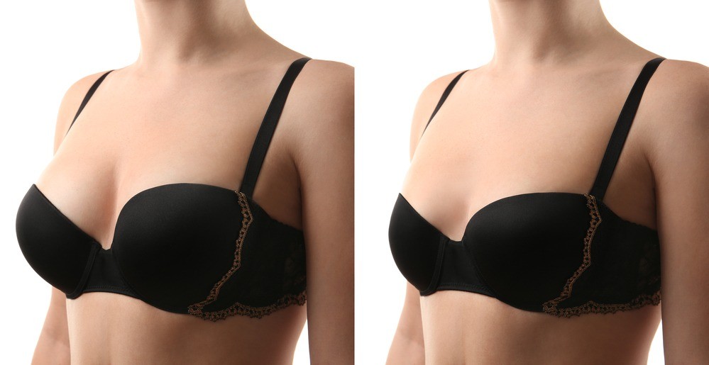 best breast augmentation in OKC