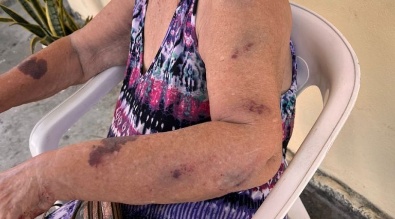 Idosa é agredida com cabo de vassoura pela neta em Manaus