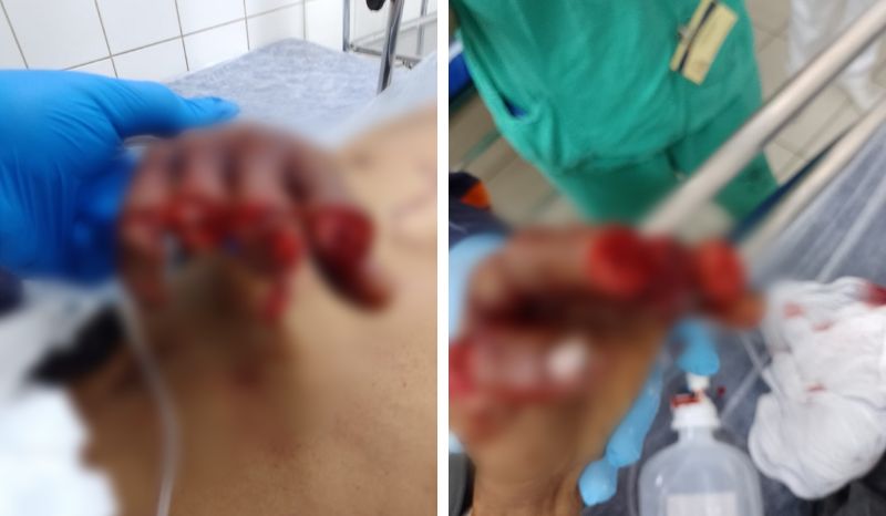 Suspeito de roubos tem quase todos os dedos decepados no ‘tribunal do crime’