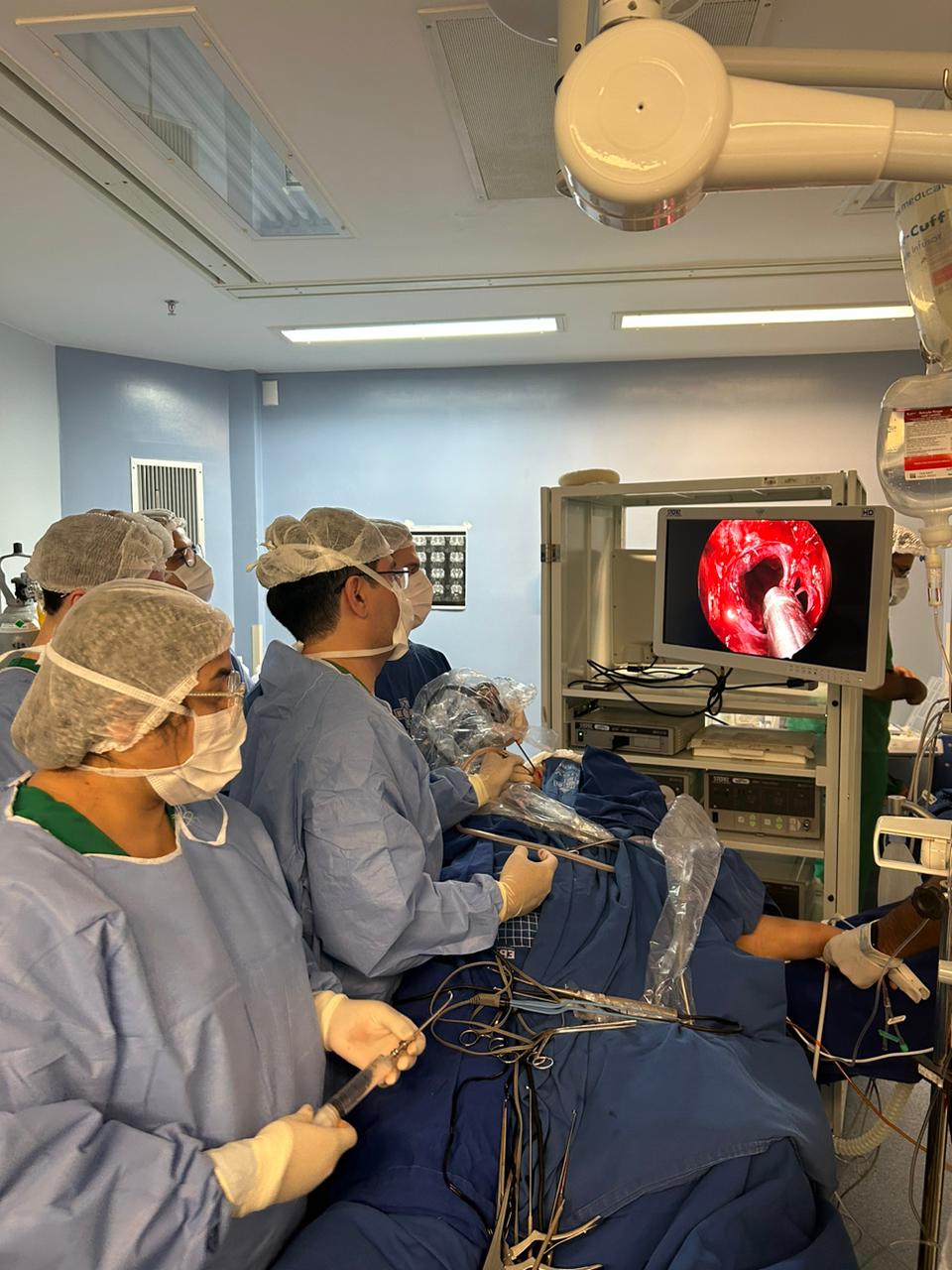HUGV realiza pela primeira vez procedimento que retira tumores por meio de pequena incisão no nariz