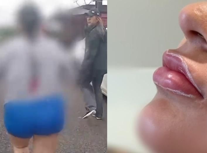 Suspeita de golpe de R$ 100 mil contra clínicas de estética e comércios é presa em Manaus