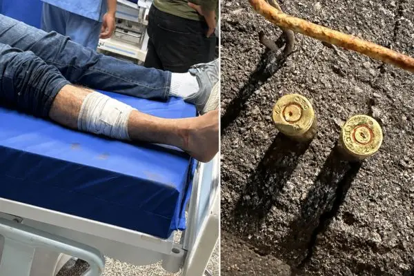 Capitão da PMAM é baleado durante montagem de comício em Manaus