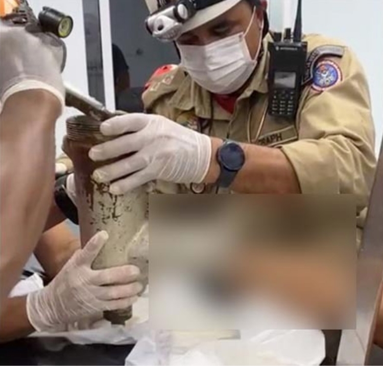 Açougueiro tem mão esmagada em moedor de carne