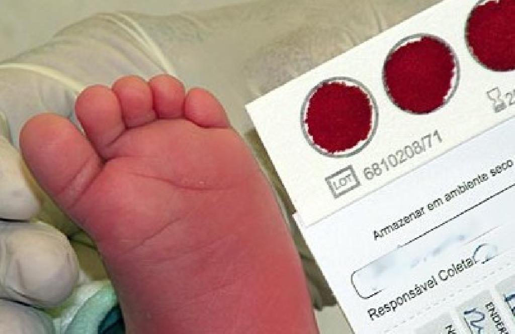 AM avança na vigilância da toxoplasmose em recém-nascidos por meio do teste do pezinho