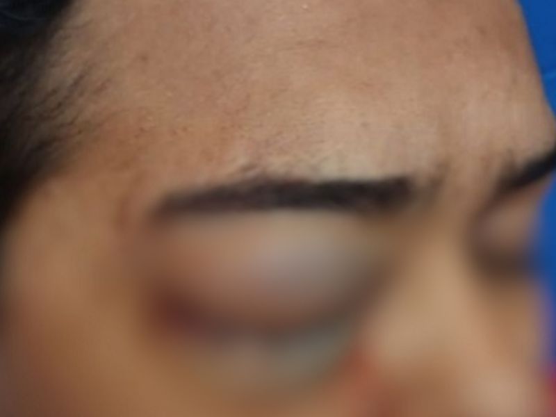 Jovem leva tiro de pressão em arraial de shopping de Manaus