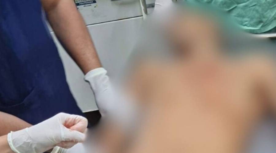 Pistoleiro do CV é morto durante confronto com a polícia na zona  Norte de Manaus