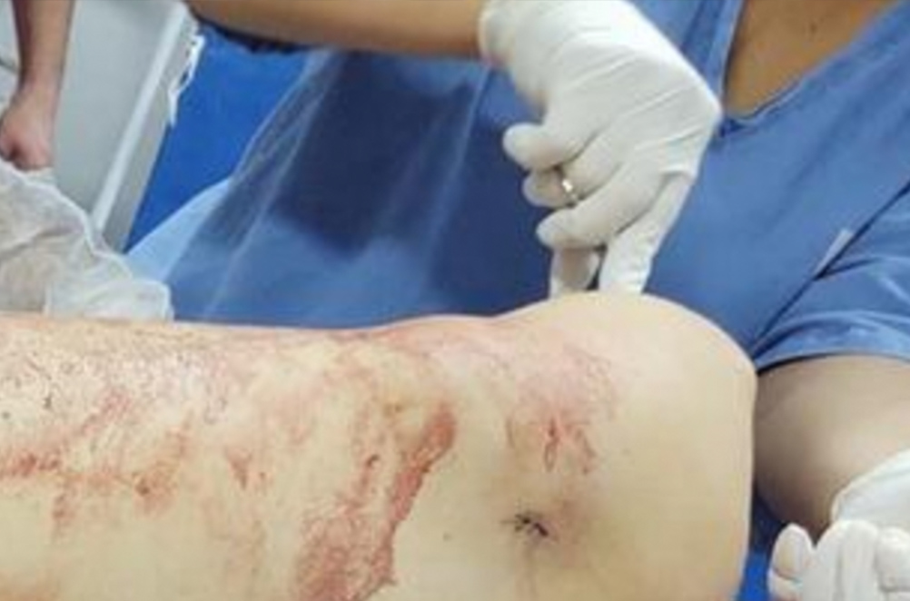 Cenas fortes: 'Branquelo' é fuzilado no Santa Etelvina