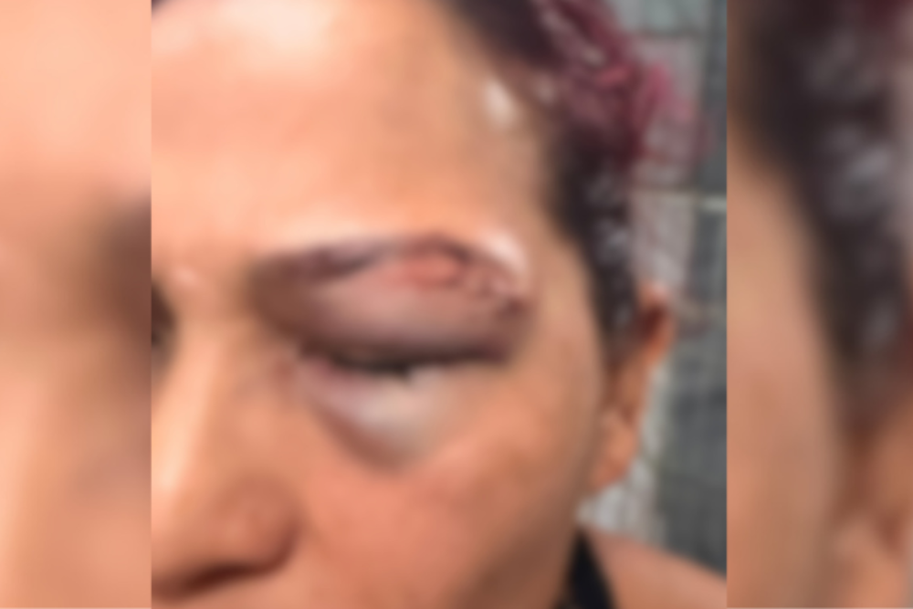 Atleta denuncia agressão cometida pelo ex-companheiro em Manaus