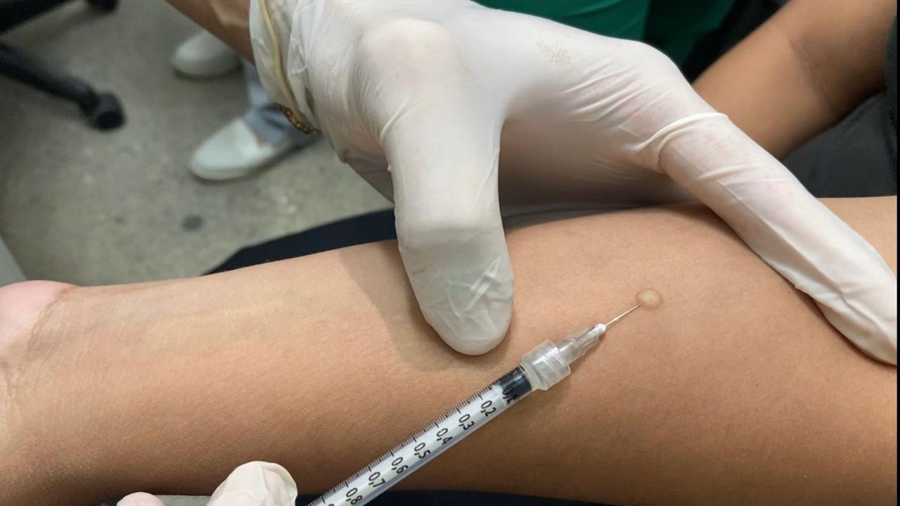 Semsa amplia oferta de teste contra tuberculose para 55 unidades de saúde em Manaus