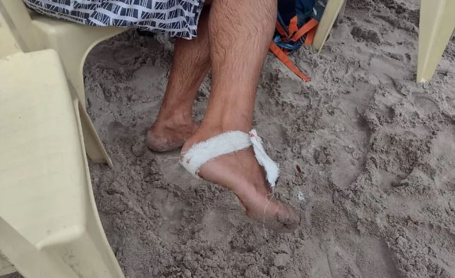 Ataque de piranhas deixa oito feridos em balneário em Manaus