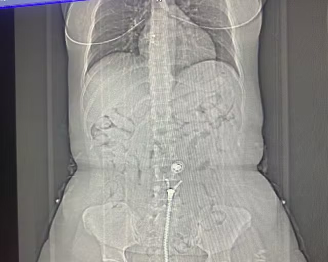 Passageiras de Manaus são presas com cocaína no estômago em voo para Europa