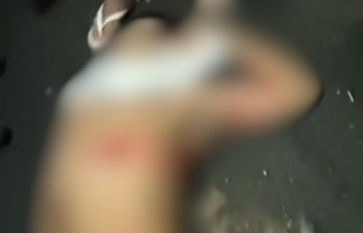 Vídeo: jovem é atraído para emboscada e morto a tiros na Compensa