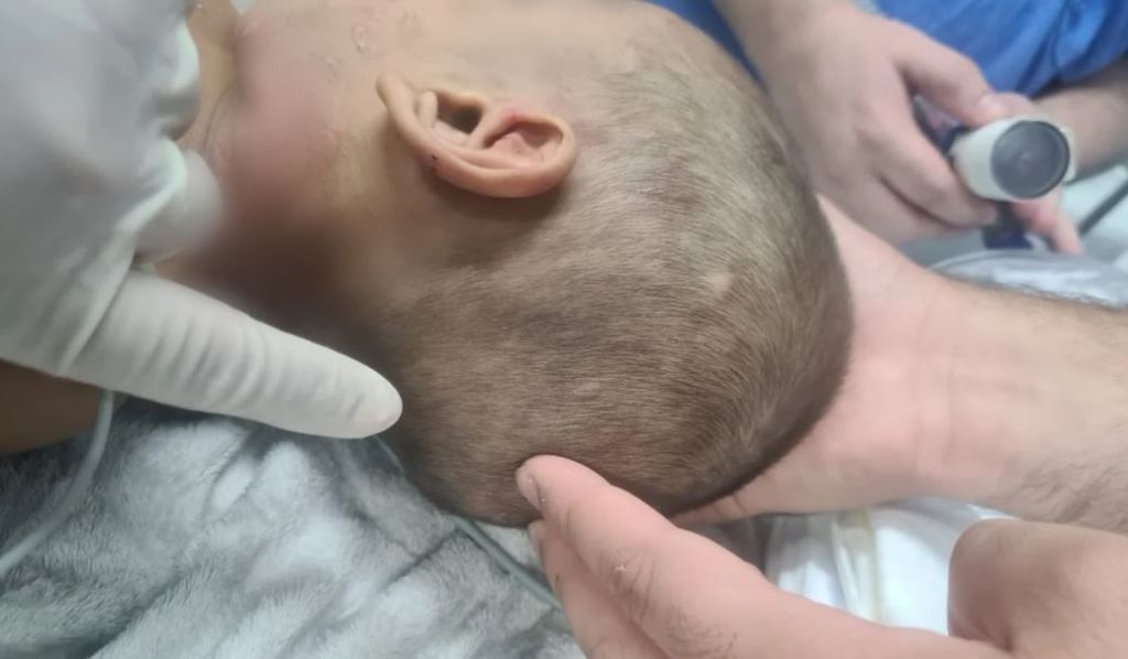 Criança de 2 anos é internada após ser espancada pelo tio