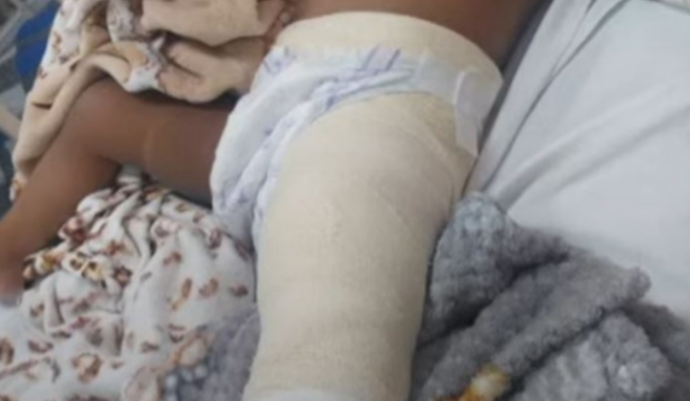 Criança é baleada durante ação policial no interior do Amazonas