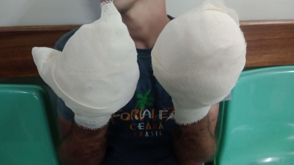 Homem é torturado e tem dedos arrancados por criminosos em Manaus; veja