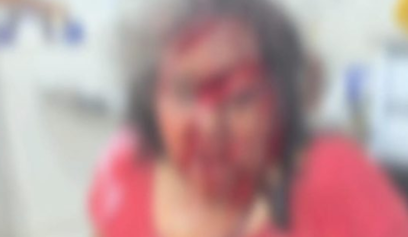 Vídeo forte: Filho desfigura rosto de mãe com terçado