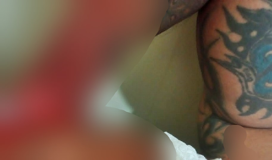 Cenas fortes: Homem tem o pé partido em três no interior do Amazonas