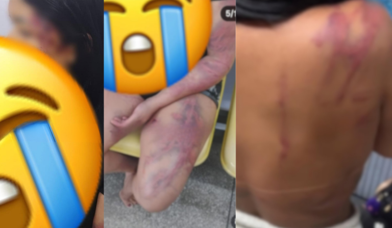 Mulher denuncia ex-namorado e a mãe dele por agressões em Manaus