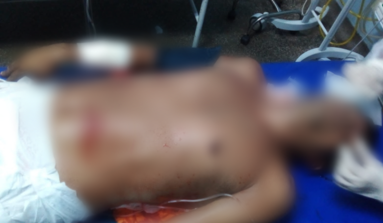 Irmão de Zé Roberto é alvo de tiros no bairro Compensa