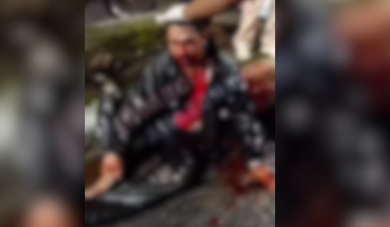 Vídeo: Motociclista fica gravemente ferido em acidente no Distrito Industrial