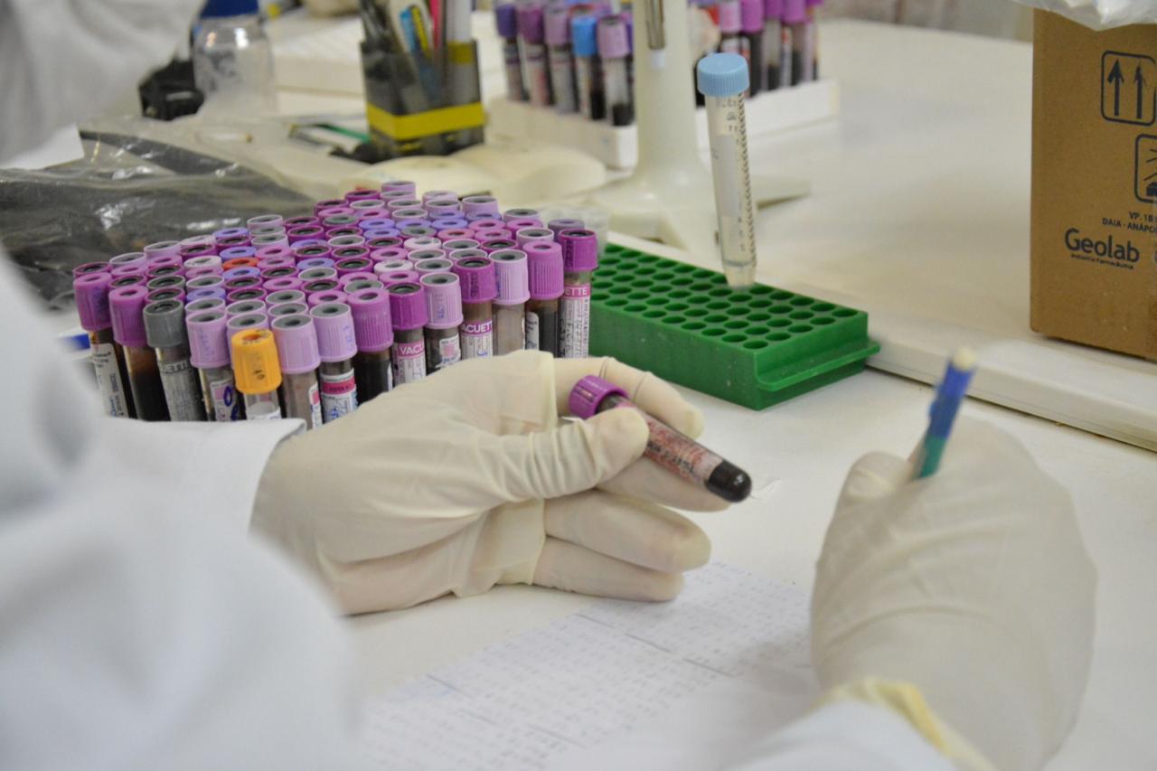 Polícia Científica do AM inicia coleta de DNA para apoiar buscas por desaparecidos