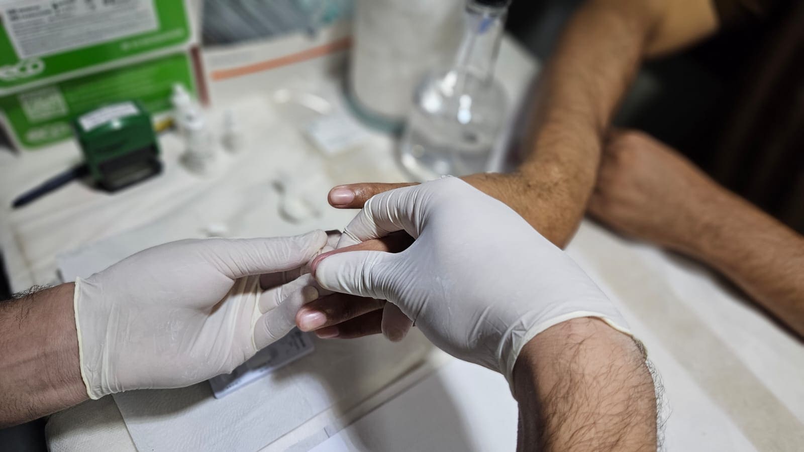 Dezembro Vermelho: Amazonas tem redução de 20,7% na mortalidade por Aids