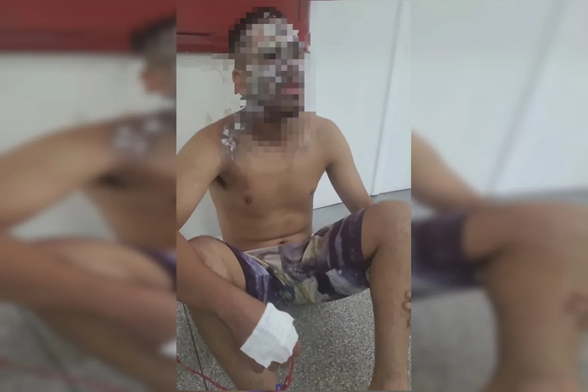 Após discussão, mulher joga água fervendo no rosto do marido