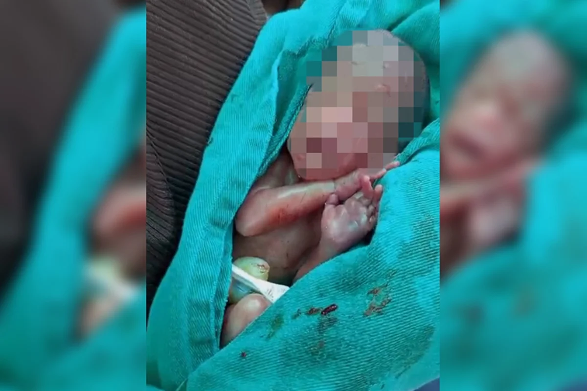 Bebê dado como morto e que chorou no caixão morre em maternidade no Acre
