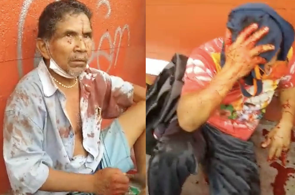 Vídeo: Homem saem no soco e terçadada por causa de mulher e traição