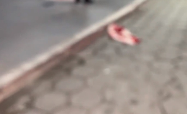 Idoso é esfaqueado durante briga de vizinhos em Manaus