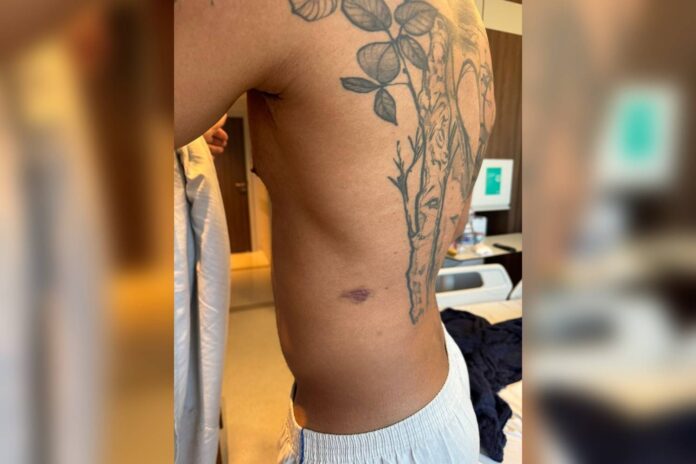 PMs são presos por suspeita de tortura contra soldado