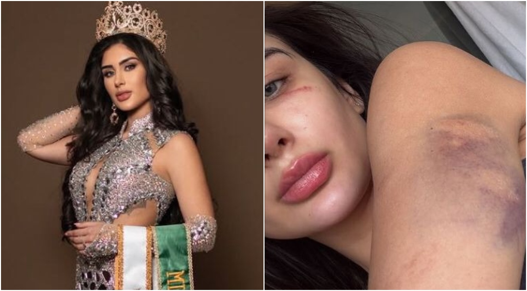 Miss Amazonas denuncia ex-namorado por agressões e ameaças em SP; veja os prints