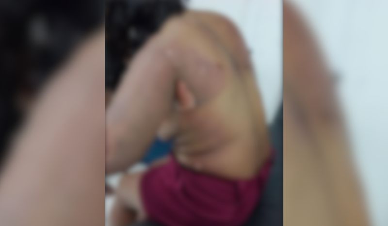 Homem é procurado por atear fogo na ex-companheira, em Parintins
