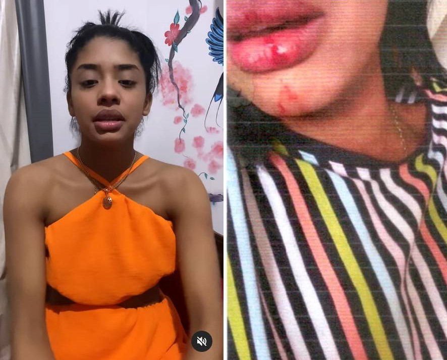 Laudo confirma lesões em ex-vocalista da Feras do Forró agredida por cantor Maykinho